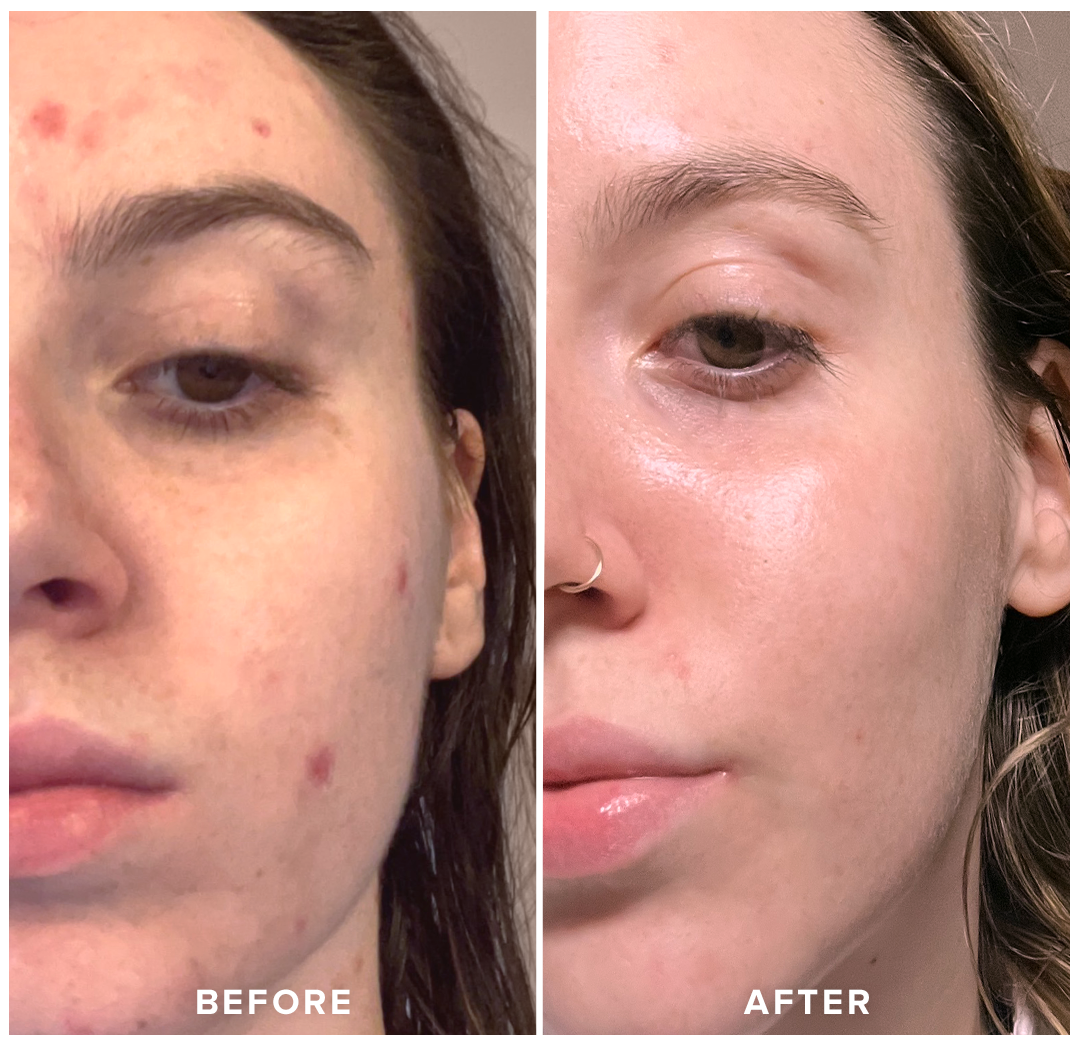 Pickerry™ GlowCube - Ice Facial Sculpting Tool