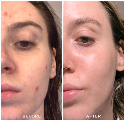 Pickerry™ GlowCube - Ice Facial Sculpting Tool