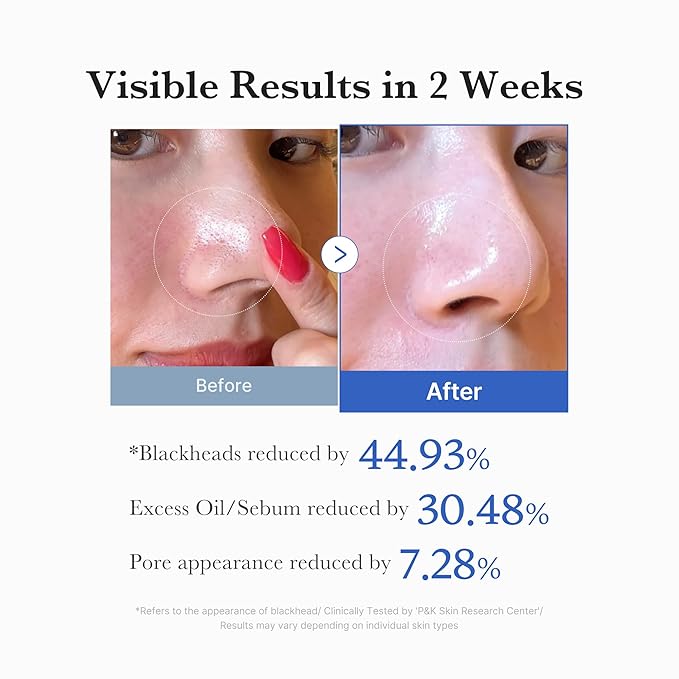 Pickerry™ Zero Pore Pad