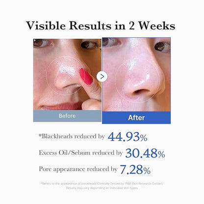 Pickerry™ Zero Pore Pad