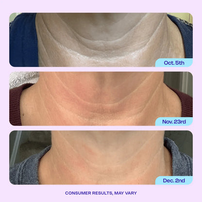 Pickerry™ Tighten & Lift Neck Cream