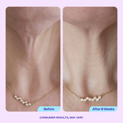 Pickerry™ Tighten & Lift Neck Cream