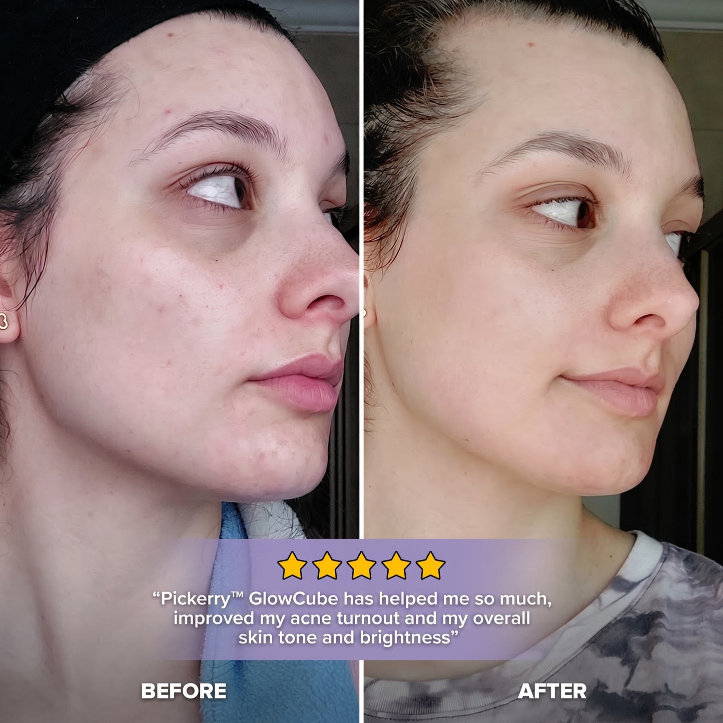 Pickerry™ GlowCube - Ice Facial Sculpting Tool